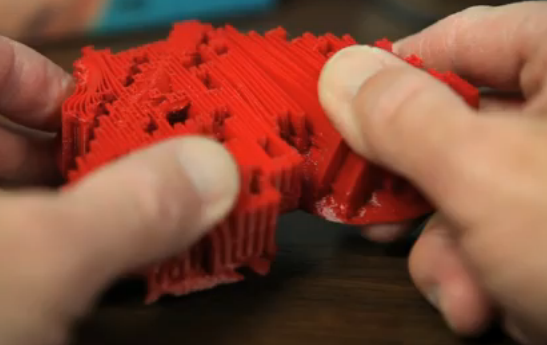 3D печать употребляют для оказания помощи 14-месячному мальчугану с пороком сердца