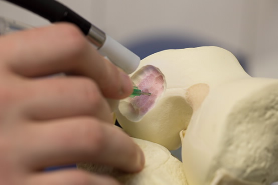 3D печатающая биоручка позволяет докторам «рисовать» личные имплантаты