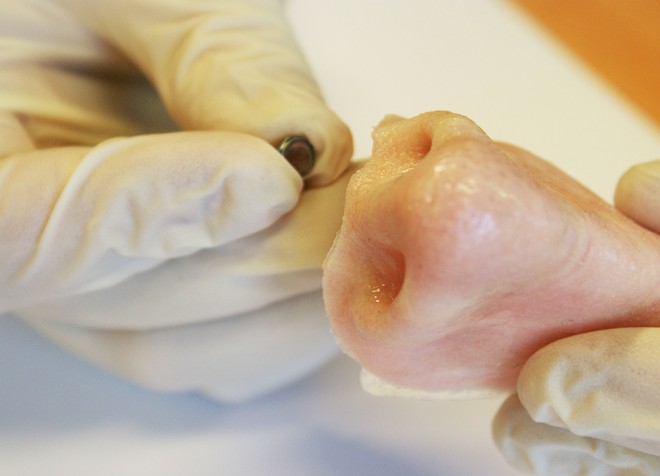 Совершенно подходящие клиентам протезы из мягенькой ткани – революция в медицине