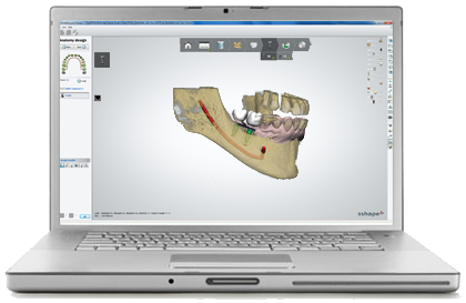 Программка для 3D печати зубных имплантатов от Stratasys