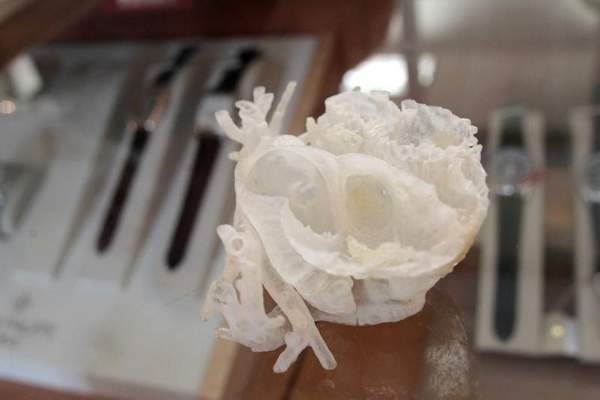3D печатные людские органы помогают докторам готовиться к операциям