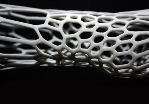 3D печатный экзоскелет Cortex — подмена гипсовой повязки