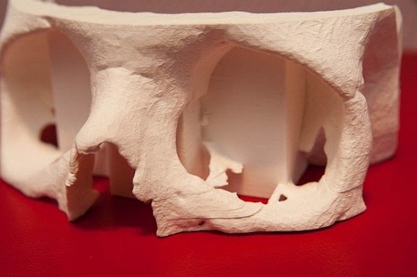 3D печать Mcor упрощает работу докторам