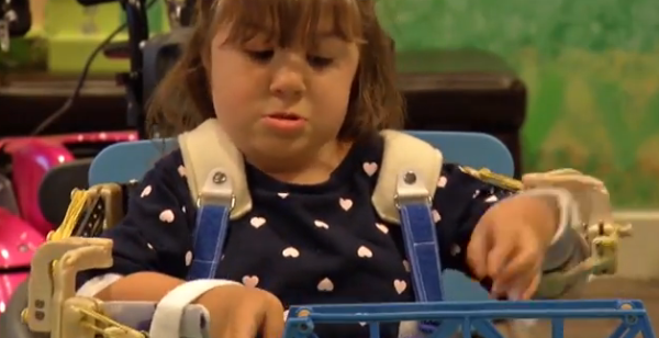 3D принтер возвратил 4-летней Ханне руки (+ видео)