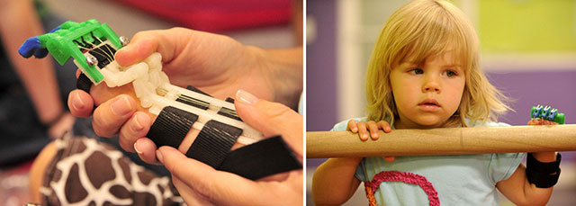 3D печатный протез для девченки и публичное роль