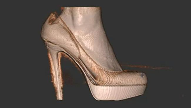 3D  сканирование показало, как высочайшие каблуки оказывают влияние на ступни