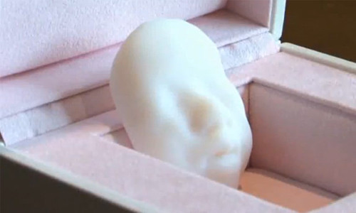 3D технологии позволяют мамам узреть лица малышей ещё во время беременности