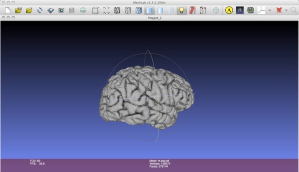Как 3D напечатать свой мозг
