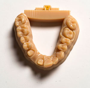 Новый материал для 3D печати в стоматологии VeroDentPlus