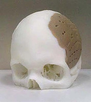 3D печать у вас в черепе