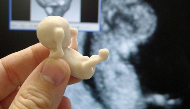 3D печатные модели эмбрионов