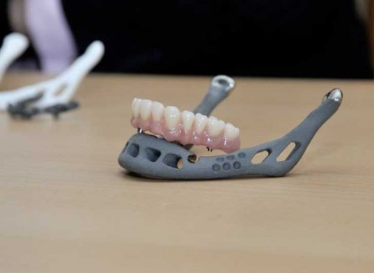 Нижние челюсти из 3D принтера