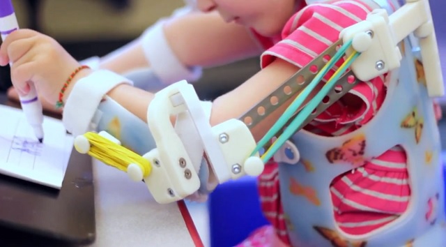 Проект Andiamo – доступные 3D печатные протезы для малышей