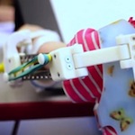 Проект Andiamo – доступные 3D печатные протезы для малышей
